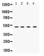 UBE2Q2 Antibody in Western Blot (WB)