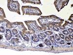 UGT1A1 Polyclonal Antibody