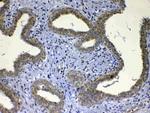 UGT1A1 Antibody in Immunohistochemistry (Paraffin) (IHC (P))