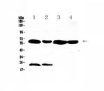 UGT1A1 Antibody in Western Blot (WB)