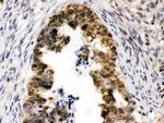 UHRF1 Antibody in Immunohistochemistry (Paraffin) (IHC (P))