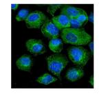 VAPB Polyclonal Antibody