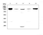 VCAM-1 (CD106) Antibody in Western Blot (WB)