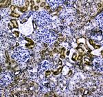 VCAM-1 (CD106) Antibody in Immunohistochemistry (Paraffin) (IHC (P))