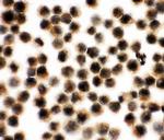 VCP Antibody in Immunocytochemistry (ICC/IF)