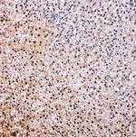 VCP Antibody in Immunohistochemistry (Paraffin) (IHC (P))