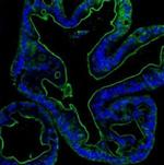 Villin Antibody in Immunohistochemistry (Paraffin) (IHC (P))