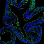 Villin Antibody in Immunohistochemistry (Paraffin) (IHC (P))
