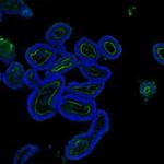 Villin Polyclonal Antibody