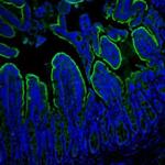 Villin Antibody in Immunohistochemistry (Paraffin) (IHC (P))