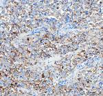 WISP1 Polyclonal Antibody