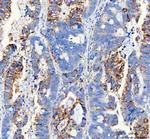 WISP1 Antibody in Immunohistochemistry (Paraffin) (IHC (P))