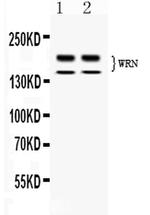 WRN Polyclonal Antibody