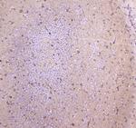 WWOX Antibody in Immunohistochemistry (Paraffin) (IHC (P))