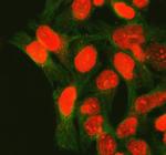 XRCC1 Polyclonal Antibody