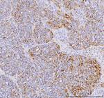 YBX1 Polyclonal Antibody