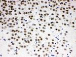 Pokemon Antibody in Immunohistochemistry (Paraffin) (IHC (P))