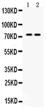 Pokemon Antibody in Western Blot (WB)