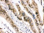 Pokemon Antibody in Immunohistochemistry (Paraffin) (IHC (P))