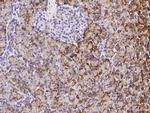 REG1A Polyclonal Antibody