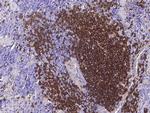 CD20 Antibody in Immunohistochemistry (Paraffin) (IHC (P))