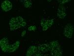ABCD1 Polyclonal Antibody