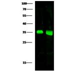 ACBD6 Polyclonal Antibody