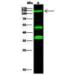 ATP Citrate Lyase Polyclonal Antibody