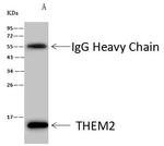 THEM2 Antibody in Immunoprecipitation (IP)