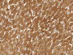 ACSS3 Antibody in Immunohistochemistry (Paraffin) (IHC (P))