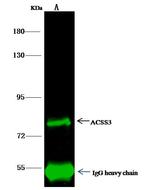 ACSS3 Antibody in Immunoprecipitation (IP)
