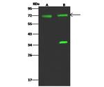 ACSS3 Antibody in Western Blot (WB)