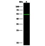 ACVR1B Polyclonal Antibody