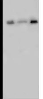 ACVR2A Antibody in Western Blot (WB)