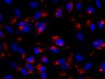 Adenosine Deaminase Polyclonal Antibody