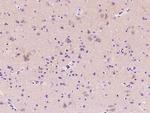 Adenosine Deaminase Polyclonal Antibody