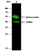 ADPRH Antibody in Immunoprecipitation (IP)
