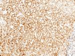 Intestinal Alkaline Phosphatase Antibody in Immunohistochemistry (Paraffin) (IHC (P))