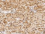 PHAP I Antibody in Immunohistochemistry (Paraffin) (IHC (P))