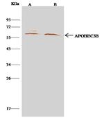 APOBEC3B Antibody in Immunoprecipitation (IP)