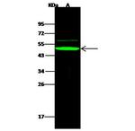APOBEC3B Polyclonal Antibody