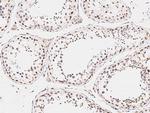 ARHGAP28 Polyclonal Antibody