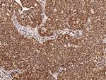 DRIL1 Antibody in Immunohistochemistry (Paraffin) (IHC (P))