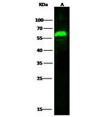 Arylsulfatase A Polyclonal Antibody