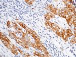 ASGR1 Antibody in Immunohistochemistry (Paraffin) (IHC (P))