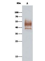 ASGR1 Antibody in Immunoprecipitation (IP)