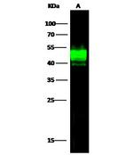 ASGR1 Antibody in Western Blot (WB)
