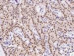 ATF1 Polyclonal Antibody