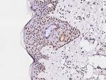 ATF1 Antibody in Immunohistochemistry (Paraffin) (IHC (P))