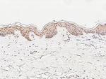 ATF1 Antibody in Immunohistochemistry (Paraffin) (IHC (P))
